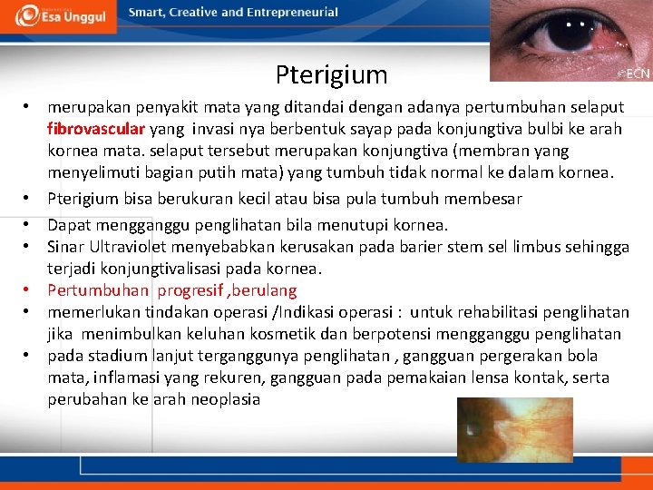 Pterigium • merupakan penyakit mata yang ditandai dengan adanya pertumbuhan selaput fibrovascular yang invasi Pterigium • merupakan penyakit mata yang ditandai dengan adanya pertumbuhan selaput fibrovascular yang invasi