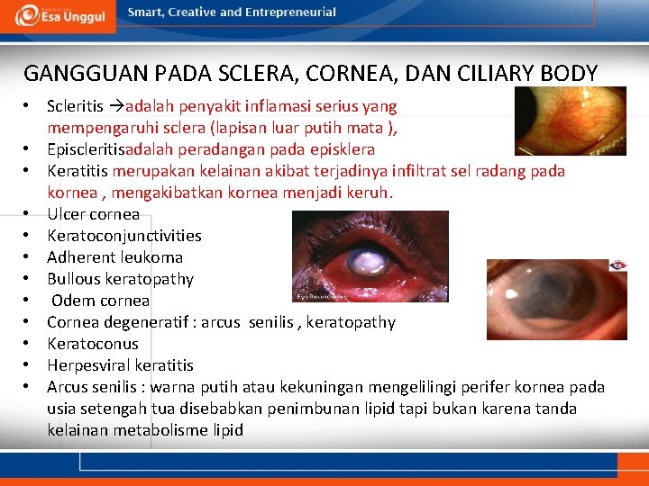 GANGGUAN PADA SCLERA, CORNEA, DAN CILIARY BODY • Scleritis adalah penyakit inflamasi serius yang GANGGUAN PADA SCLERA, CORNEA, DAN CILIARY BODY • Scleritis adalah penyakit inflamasi serius yang