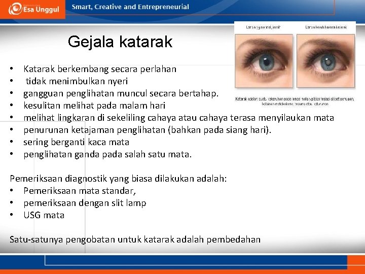 Gejala katarak • • Katarak berkembang secara perlahan tidak menimbulkan nyeri gangguan penglihatan muncul Gejala katarak • • Katarak berkembang secara perlahan tidak menimbulkan nyeri gangguan penglihatan muncul
