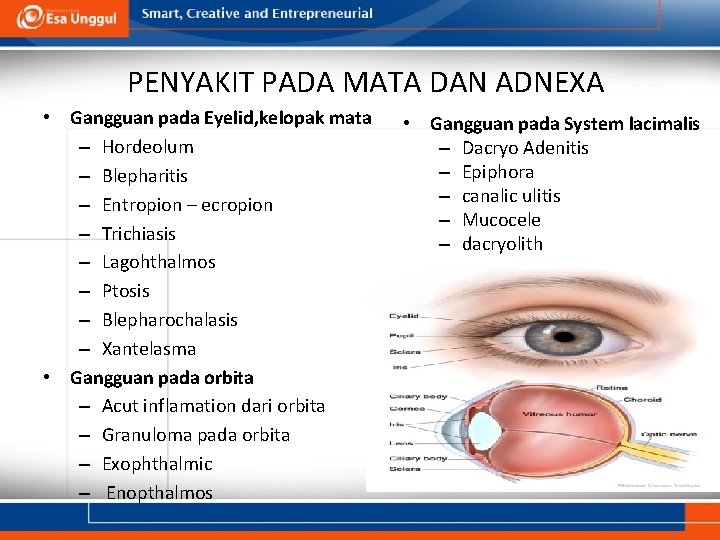 PENYAKIT PADA MATA DAN ADNEXA • Gangguan pada Eyelid, kelopak mata – Hordeolum – PENYAKIT PADA MATA DAN ADNEXA • Gangguan pada Eyelid, kelopak mata – Hordeolum –