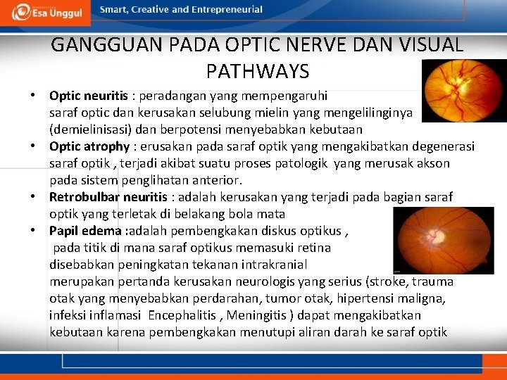 GANGGUAN PADA OPTIC NERVE DAN VISUAL PATHWAYS • Optic neuritis : peradangan yang mempengaruhi GANGGUAN PADA OPTIC NERVE DAN VISUAL PATHWAYS • Optic neuritis : peradangan yang mempengaruhi