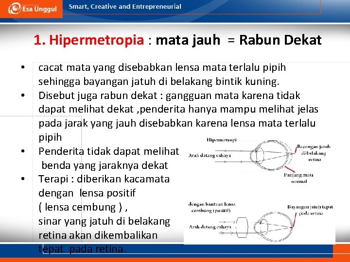 1. Hipermetropia : mata jauh = Rabun Dekat • • cacat mata yang disebabkan 1. Hipermetropia : mata jauh = Rabun Dekat • • cacat mata yang disebabkan