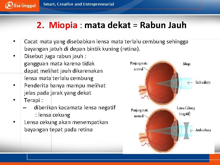 2. Miopia : mata dekat = Rabun Jauh • • • Cacat mata yang 2. Miopia : mata dekat = Rabun Jauh • • • Cacat mata yang