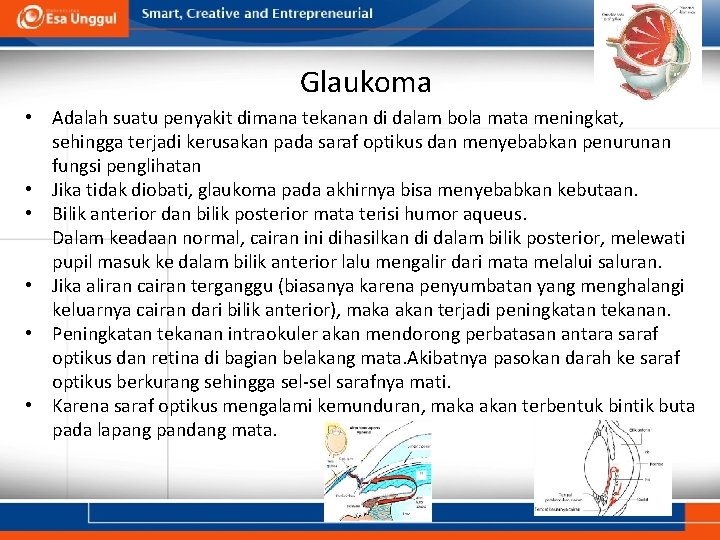 Glaukoma • Adalah suatu penyakit dimana tekanan di dalam bola mata meningkat, sehingga terjadi Glaukoma • Adalah suatu penyakit dimana tekanan di dalam bola mata meningkat, sehingga terjadi