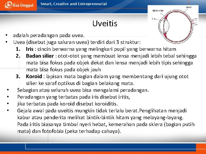 Uveitis • adalah peradangan pada uvea. • Uvea (disebut juga saluran uvea) terdiri dari Uveitis • adalah peradangan pada uvea. • Uvea (disebut juga saluran uvea) terdiri dari