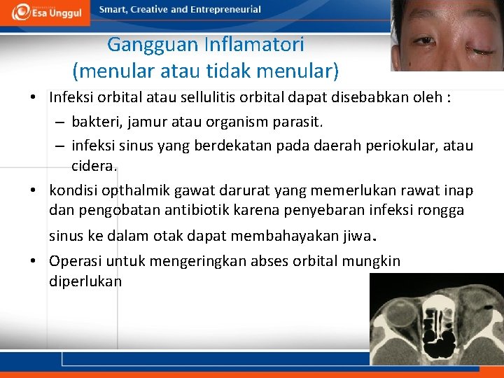 Gangguan Inflamatori (menular atau tidak menular) • Infeksi orbital atau sellulitis orbital dapat disebabkan Gangguan Inflamatori (menular atau tidak menular) • Infeksi orbital atau sellulitis orbital dapat disebabkan