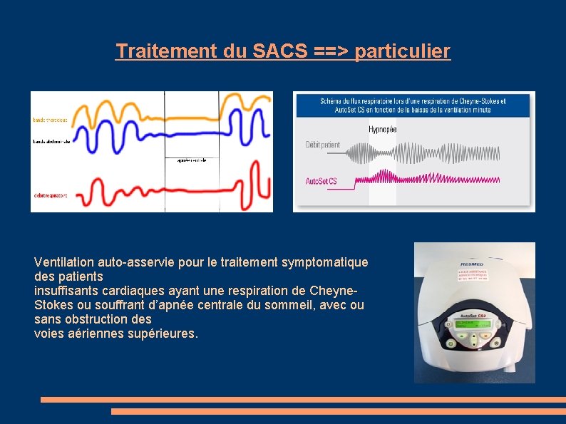 Traitement du SACS ==> particulier Ventilation auto-asservie pour le traitement symptomatique des patients insuffisants