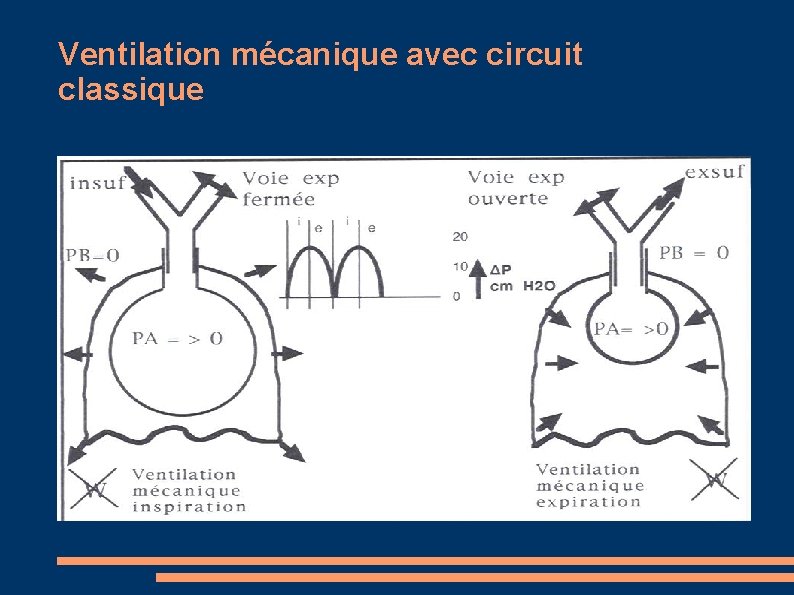 Ventilation mécanique avec circuit classique 