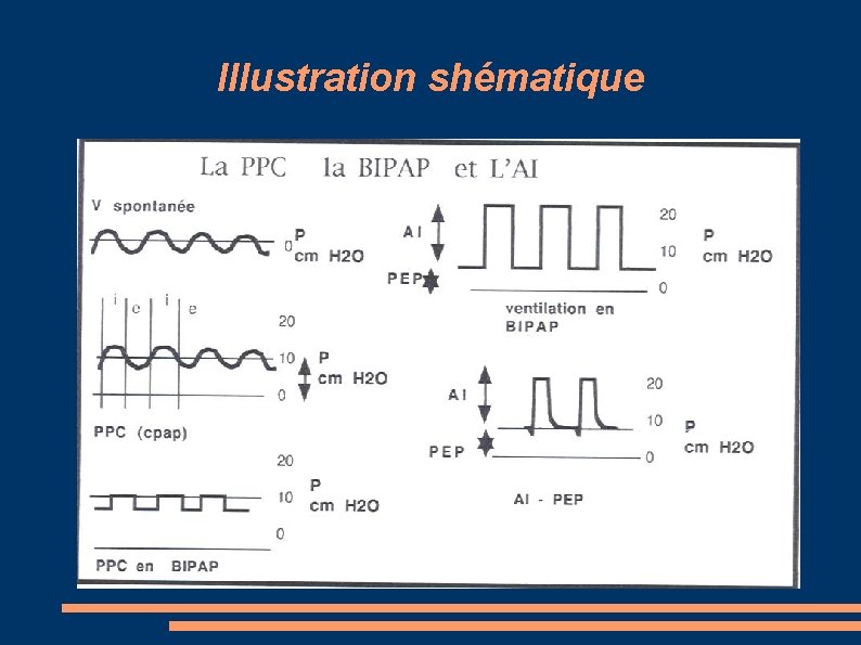 Illustration shématique 