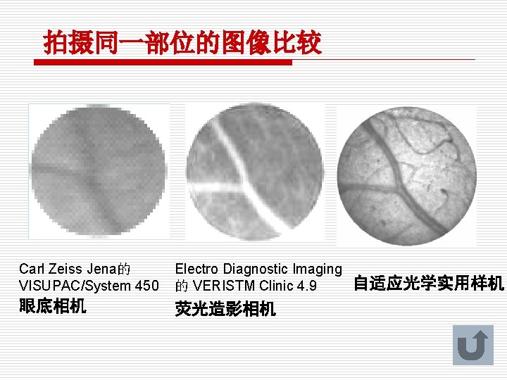 拍摄同一部位的图像比较 Carl Zeiss Jena的 VISUPAC/System 450 Electro Diagnostic Imaging 的 VERISTM Clinic 4. 9