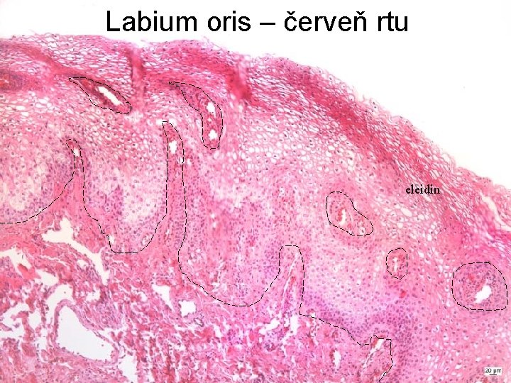 Labium oris – červeň rtu eleidin 
