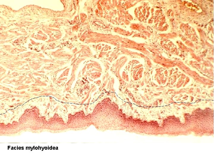 Facies mylohyoidea Facies mylohyoidea