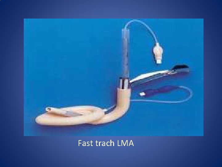 Fast trach LMA Fast trach LMA