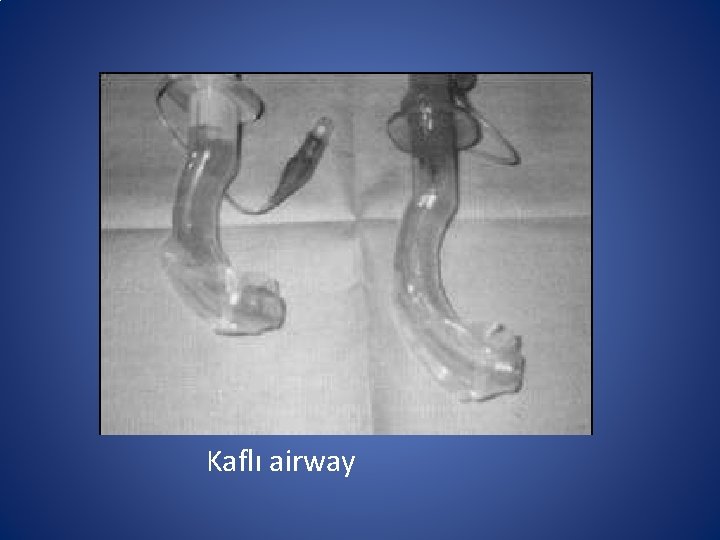Kaflı airway Kaflı airway