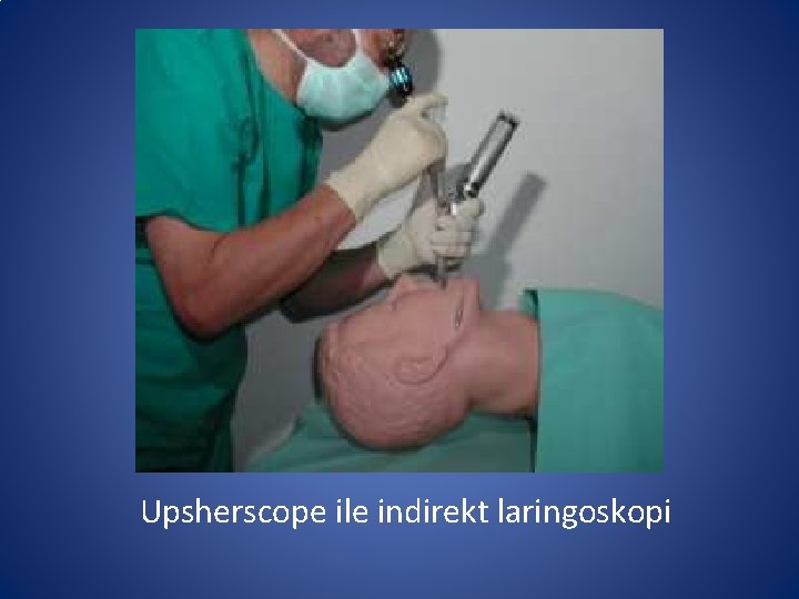 Upsherscope ile indirekt laringoskopi Upsherscope ile indirekt laringoskopi
