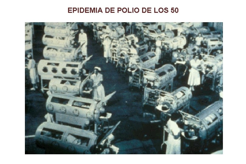 EPIDEMIA DE POLIO DE LOS 50 