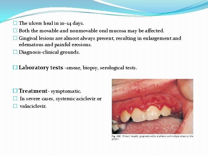 � The ulcers heal in 10– 14 days. � Both the movable and nonmovable