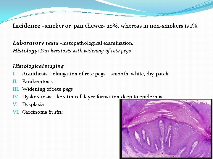 Incidence –smoker or pan chewer- 20%, whereas in non-smokers is 1%. Laboratory tests -histopathological