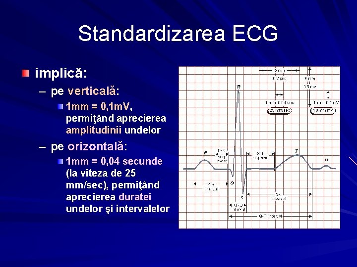 Standardizarea ECG implică: – pe verticală: 1 mm = 0, 1 m. V, permiţând