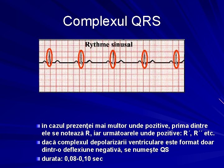 Complexul QRS în cazul prezenţei mai multor unde pozitive, prima dintre ele se notează