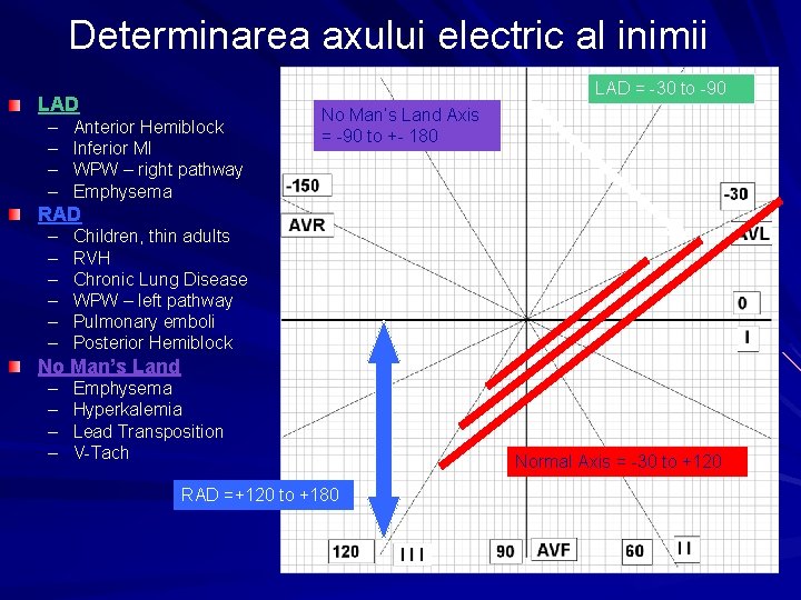 Determinarea axului electric al inimii LAD = -30 to -90 LAD – – Anterior