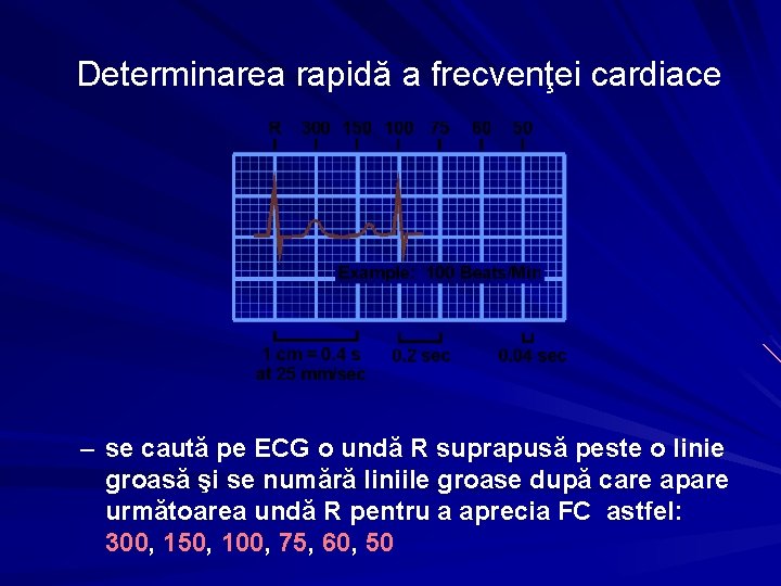 Determinarea rapidă a frecvenţei cardiace – se caută pe ECG o undă R suprapusă