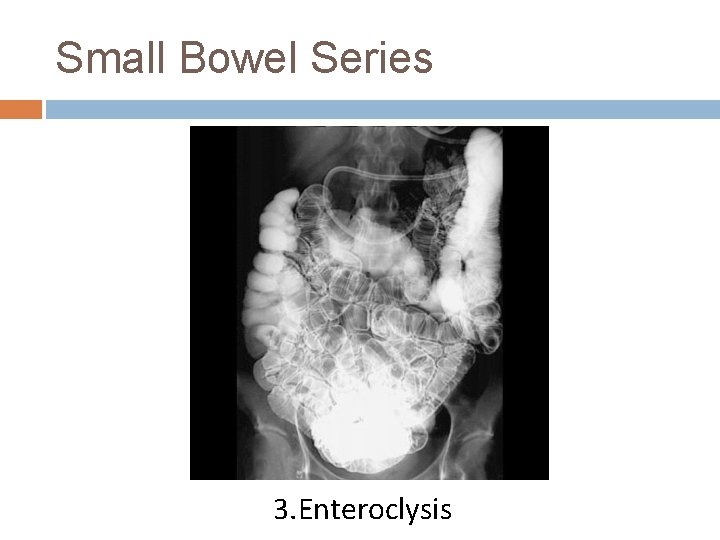 Small Bowel Series 3. Enteroclysis 
