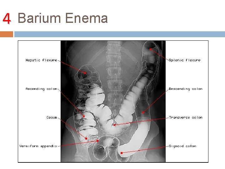 4 Barium Enema 