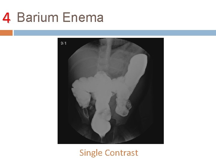 4 Barium Enema Single Contrast 