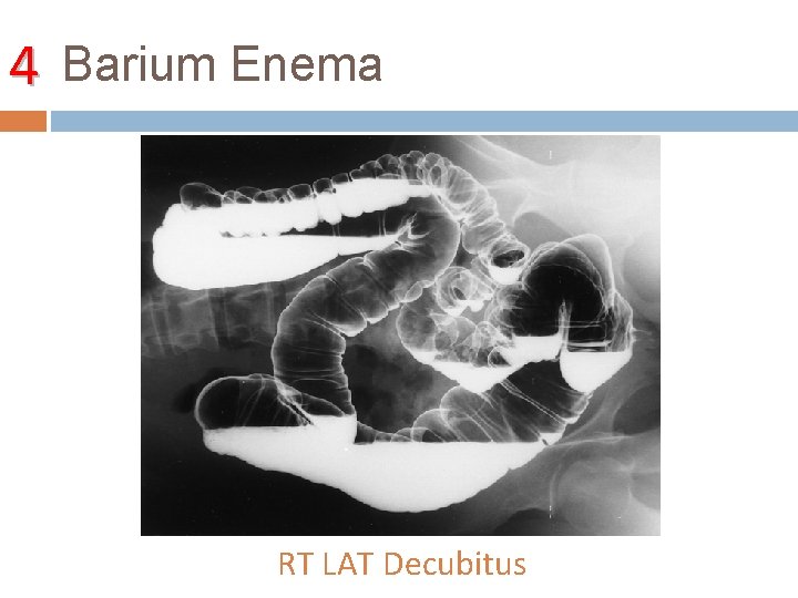 4 Barium Enema RT LAT Decubitus 