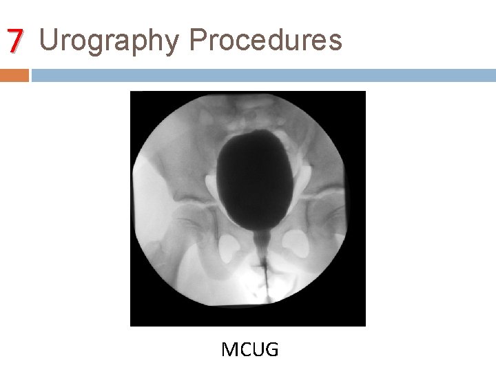 7 Urography Procedures MCUG 