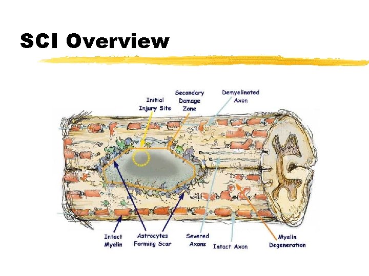 SCI Overview 