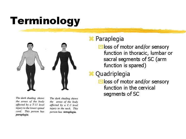Terminology z Paraplegia y loss of motor and/or sensory function in thoracic, lumbar or