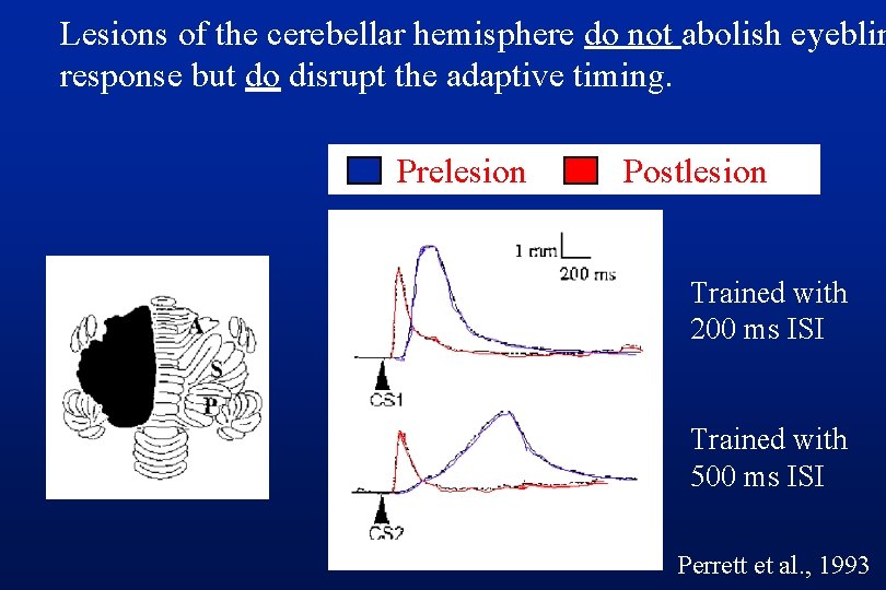 Lesions of the cerebellar hemisphere do not abolish eyeblin response but do disrupt the