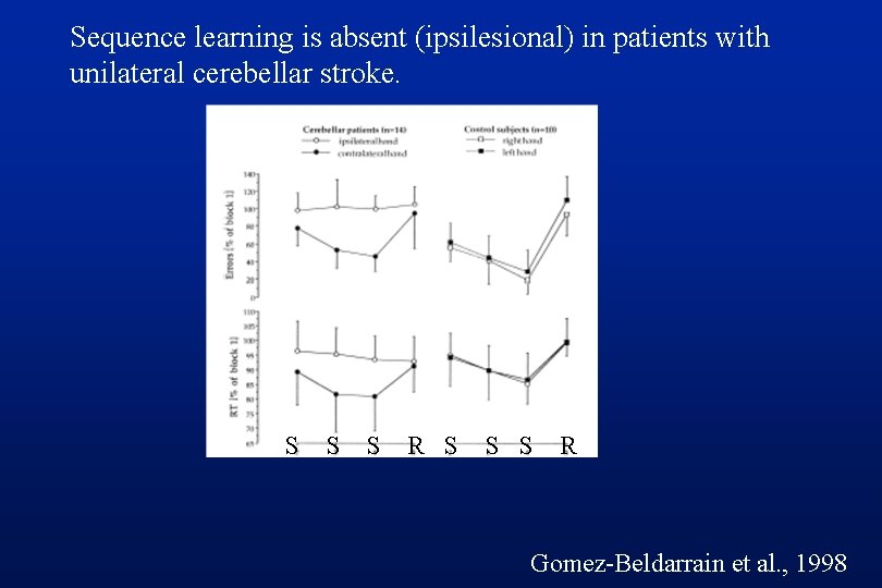 Sequence learning is absent (ipsilesional) in patients with unilateral cerebellar stroke. S S S