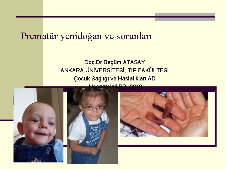 Prematür yenidoğan ve sorunları Doç. Dr. Begüm ATASAY ANKARA ÜNİVERSİTESİ, TIP FAKÜLTESİ Çocuk Sağlığı