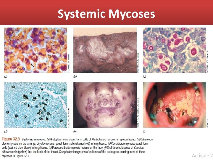 Systemic Mycoses 