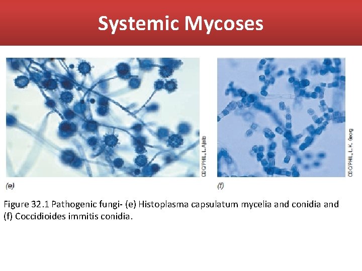 Systemic Mycoses Figure 32. 1 Pathogenic fungi- (e) Histoplasma capsulatum mycelia and conidia and