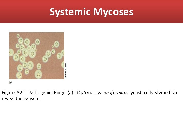 Systemic Mycoses Figure 32. 1 Pathogenic fungi. (a). Crytococcus neoformans yeast cells stained to