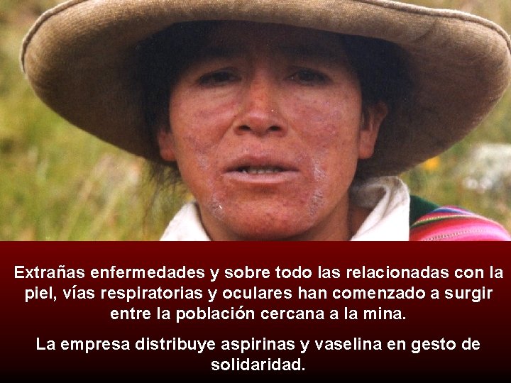 Extrañas enfermedades y sobre todo las relacionadas con la piel, vías respiratorias y oculares