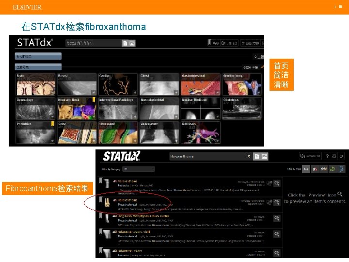  | 30 在STATdx检索fibroxanthoma 首页 简洁 清晰 Fibroxanthoma检索结果 