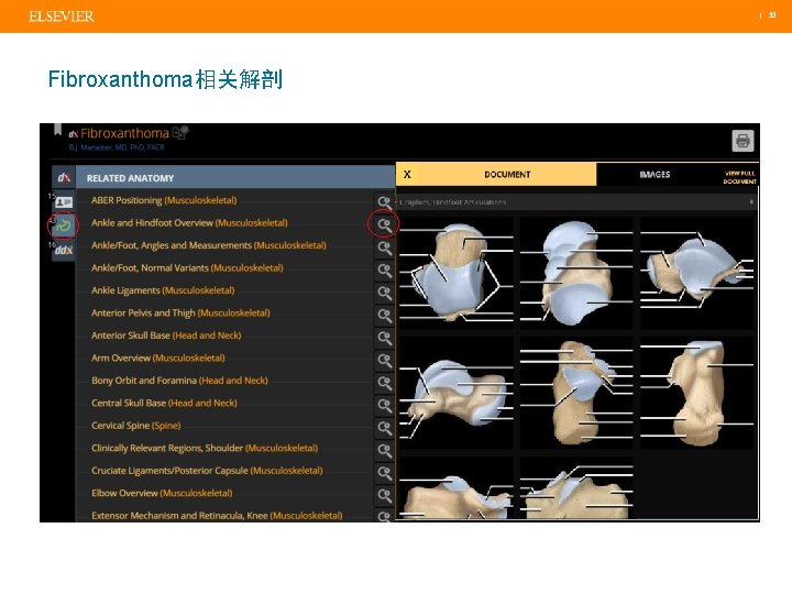  | 33 Fibroxanthoma相关解剖 