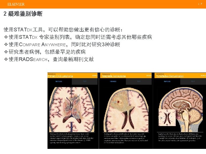 STATdx Diagnostic Decision Support for Radiology Jessie Qian