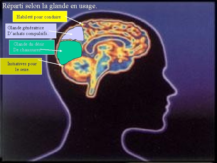 Réparti selon la glande en usage. Habileté pour conduire. Glande génératrice D’achats compulsifs. .