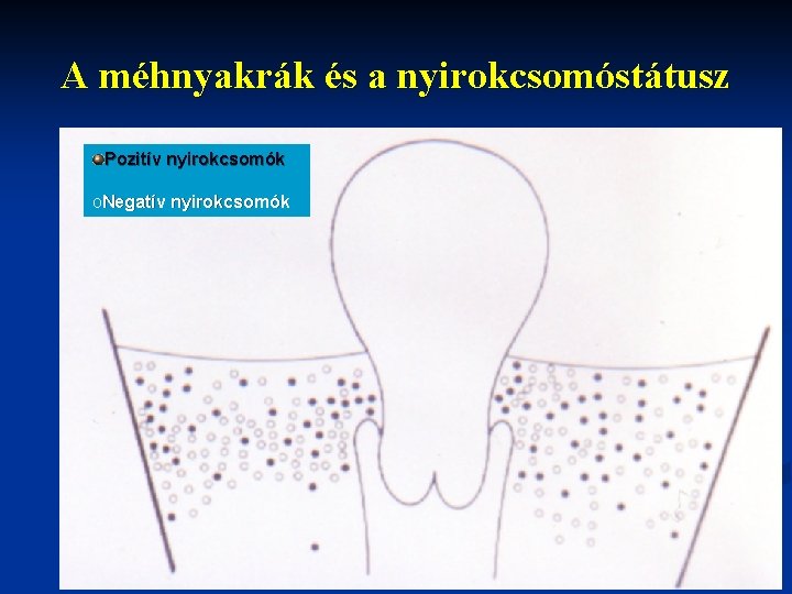 A méhnyakrák és a nyirokcsomóstátusz Pozitív nyirokcsomók o. Negatív nyirokcsomók 