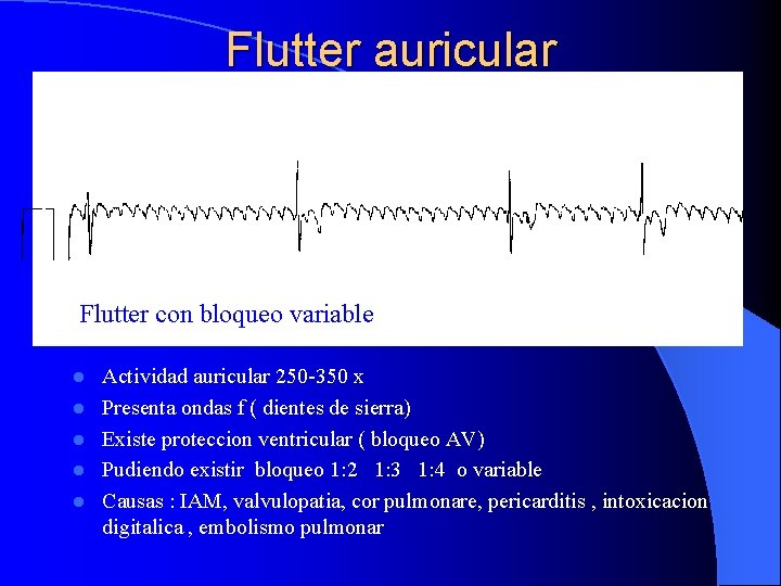 Flutter auricular Flutter con bloqueo variable l l l Actividad auricular 250 -350 x