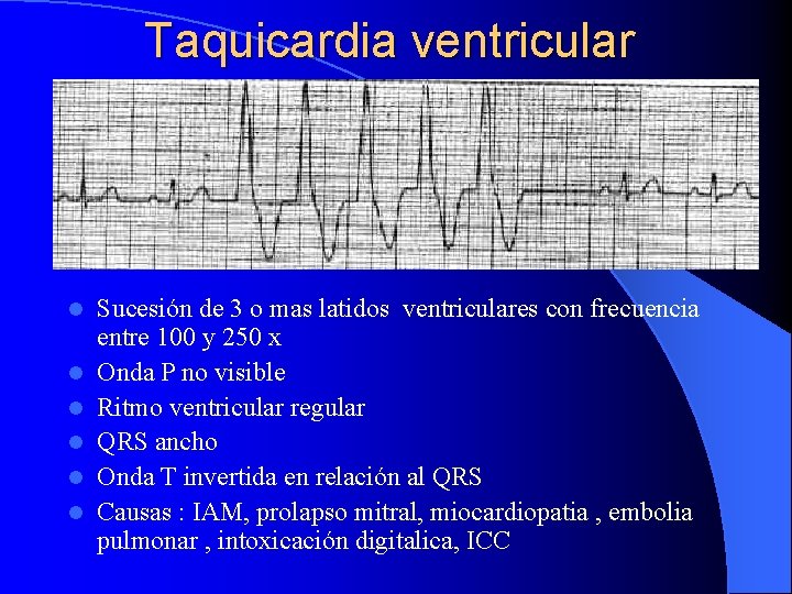 Taquicardia ventricular l l l Sucesión de 3 o mas latidos ventriculares con frecuencia