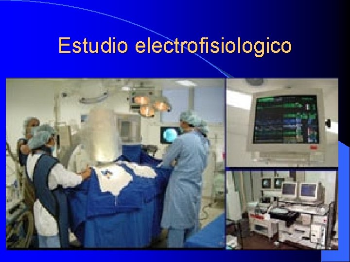 Estudio electrofisiologico 