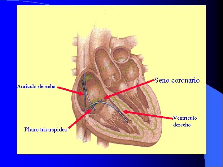 Auricula derecha Plano tricuspideo Seno coronario Ventriculo derecho 