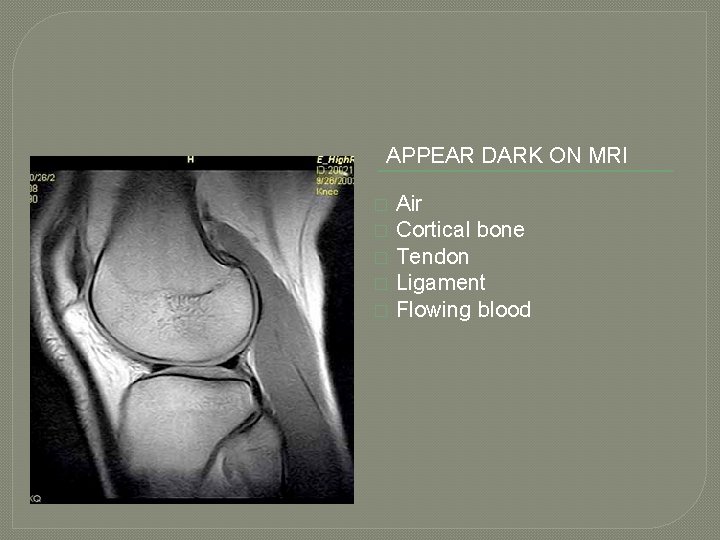 APPEAR DARK ON MRI � � � Air Cortical bone Tendon Ligament Flowing blood